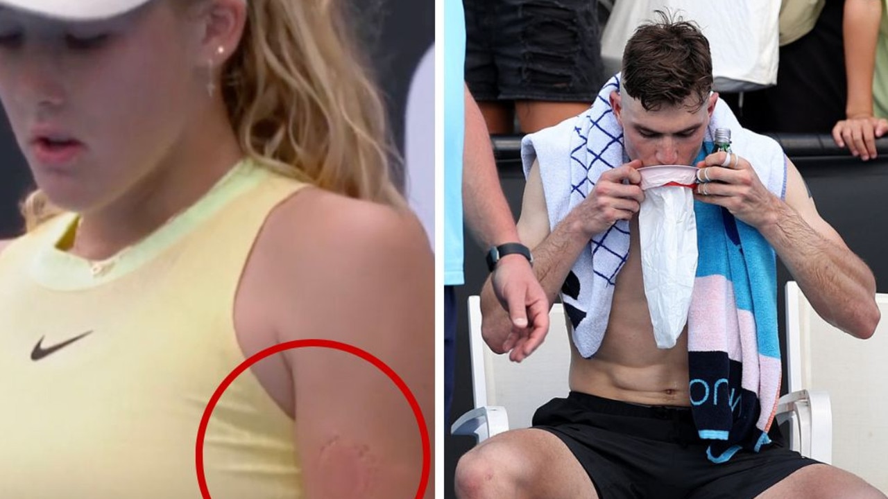 Confronting scenes at Australian Open expose harsh truth