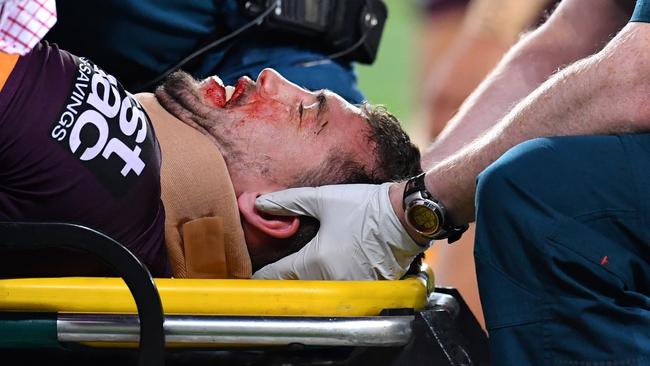 Corey Oates is stretchered off.