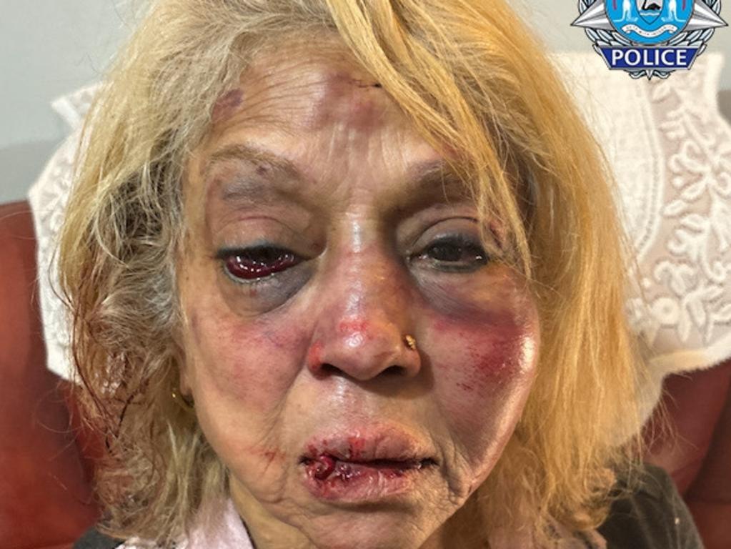 Ninette Simons received severe facial bruising and swelling after she was assaulted during a shocking home invasion at her Girrawheen home earlier this month. Credit: WA Police/Supplied