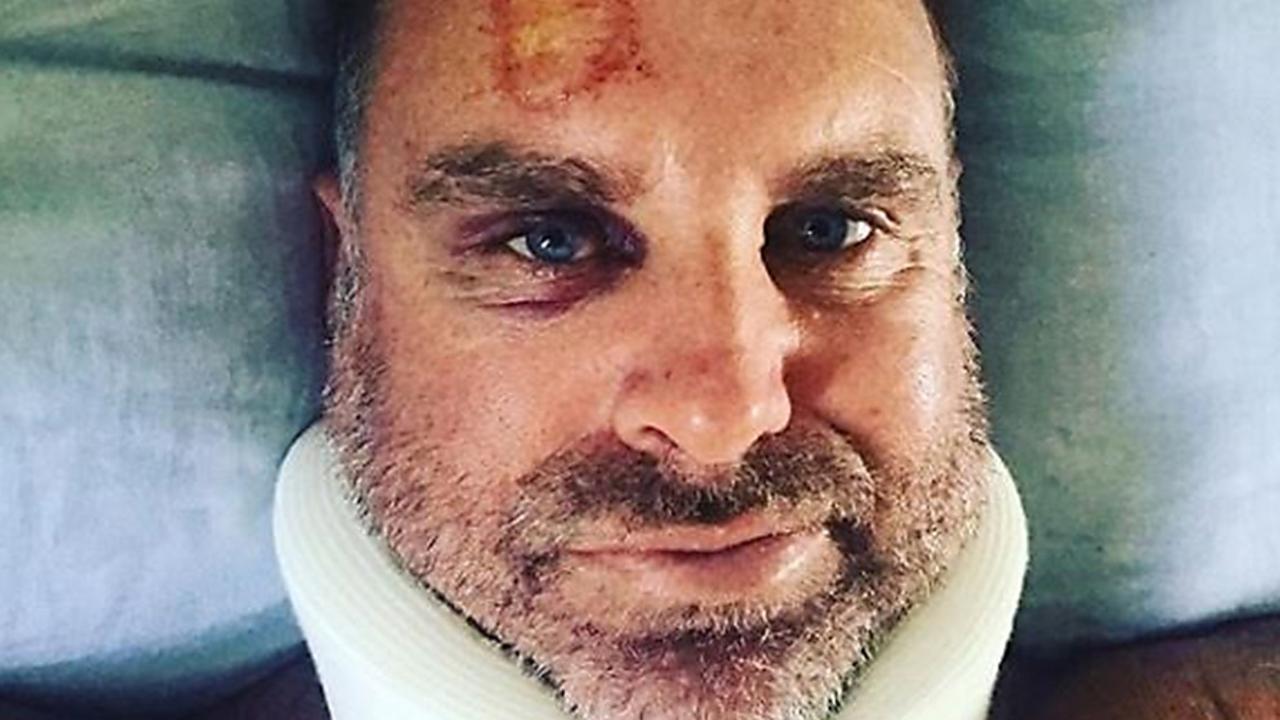 Matthew Hayden suffered a surfing accident while on holiday.