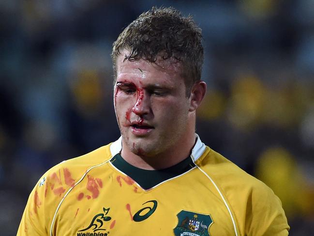 Australia's James Slipper walks off to clean blood from his face during the Bledisloe Cup Rugby Championship match against New Zealand in Sydney on August 20, 2016. / AFP PHOTO / SAEED KHAN