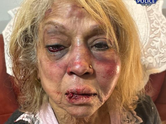 Ninette  Simons received severe facial bruising and swelling after she was  assaulted during a shocking home invasion at her Girrawheen home earlier this month.  Credit: WA Police/Supplied