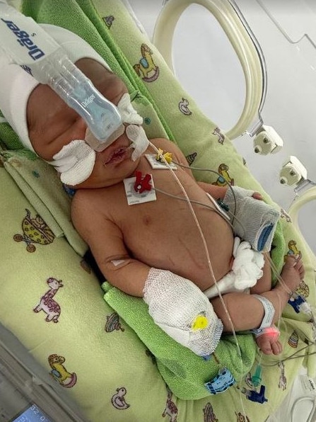 Baby Teo was born prematurely in Bali. Picture: Instagram