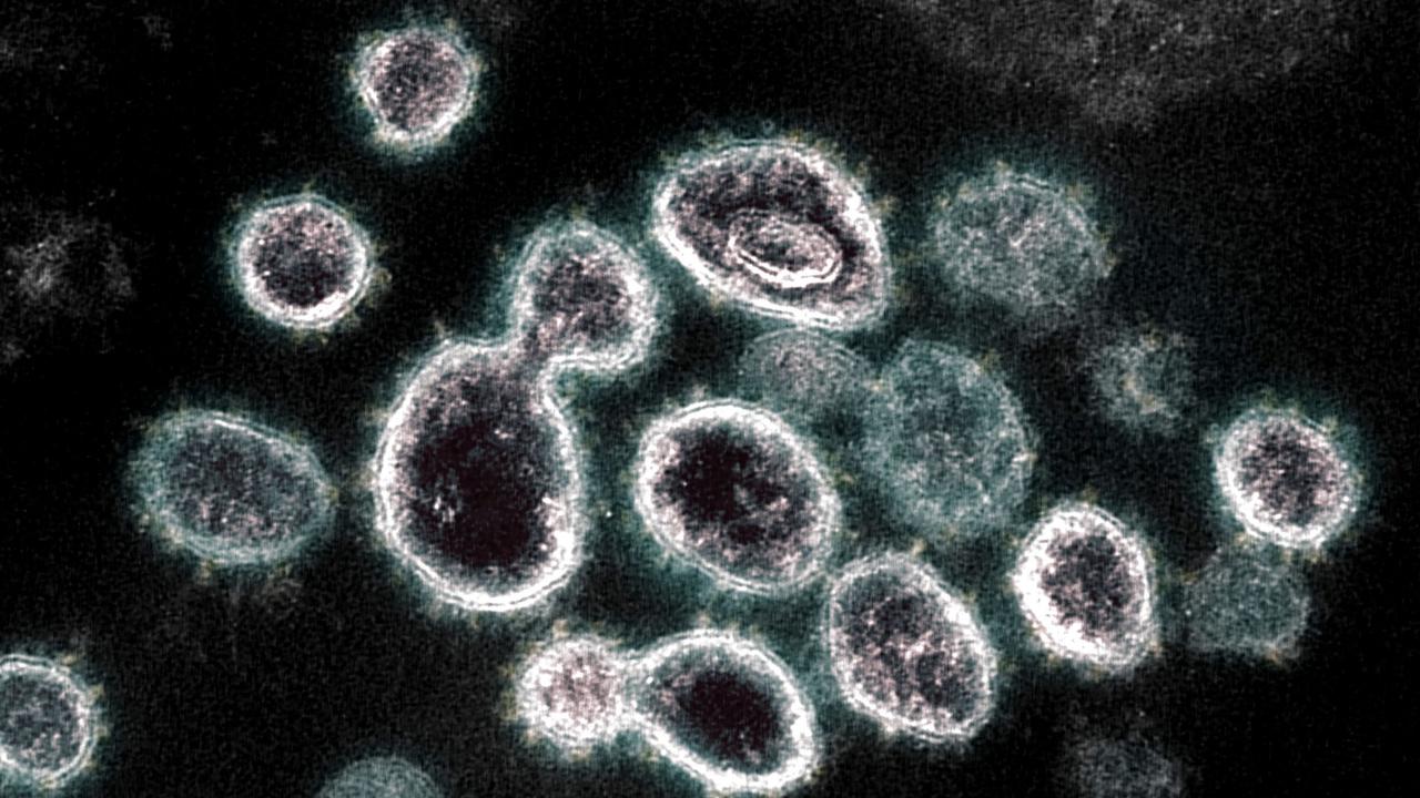 Scientists fear they ahve found the most mutated strain of the virus. CREDIT AFP PHOTO /NATIONAL INSTITUTE OF ALLERGY AND INFECTIOUS DISEASES/NIH