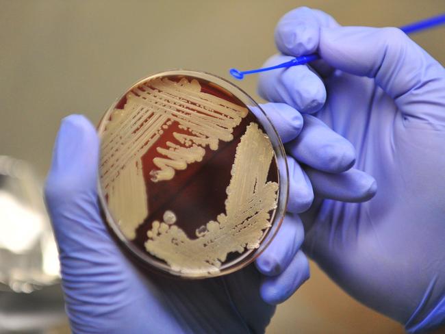 Doctor Patrick Harris holds a Melioidosis bacteria sample.