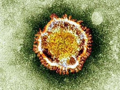 The Coronavirus seen under an electron microscope. Picture: AFP