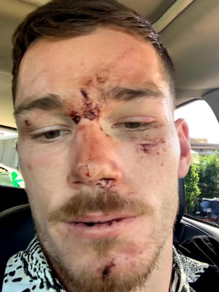 Canberra Raiders player Tom Starling after an incident with police on the Central Coast.