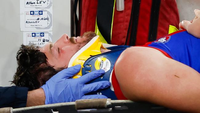 Angus Brayshaw left the ground on a stretcher after the incident. (Photo by Dylan Burns/AFL Photos via Getty Images)