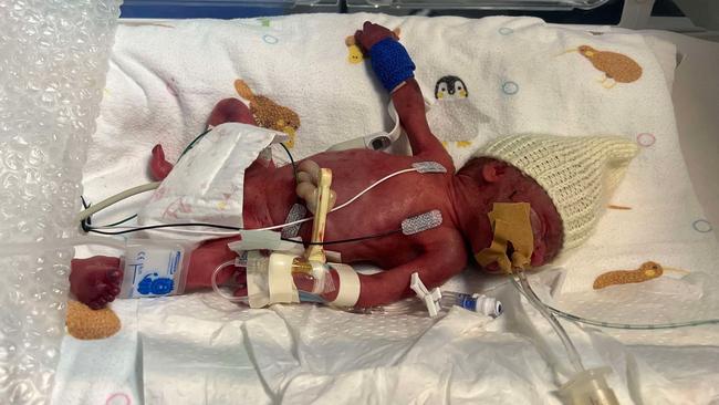 Sully was born 24 weeks premature, leading to numerous complications that kept him in the hospital for over 100 days. Picture: Supplied.