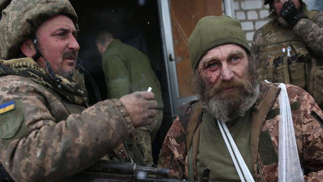 A wounded servicemen of Ukrainian Military Forces looks on after a battle with Russian troops and Russia-backed separatists in Lugansk region. Picture: AFP