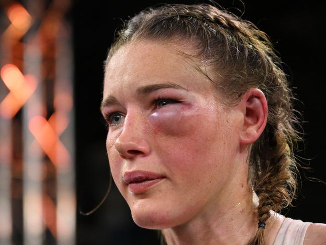 Tayla Harris copped a brutal facial injury in her title fight loss.