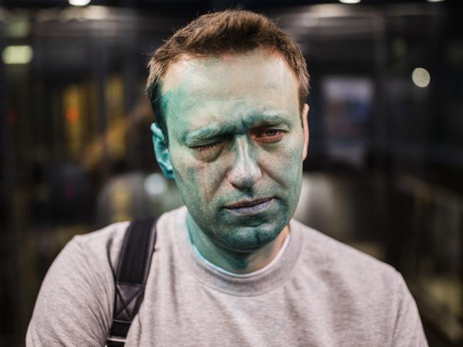 "The green face" Alexey Navalny, his face splashed with a caustic green liquid and acid after a pro-Kremlin activist’s attack, looks into the camera on a way back to his office from the hospital in Moscow. April 27, 2017 Picture - Evgeny Feldman