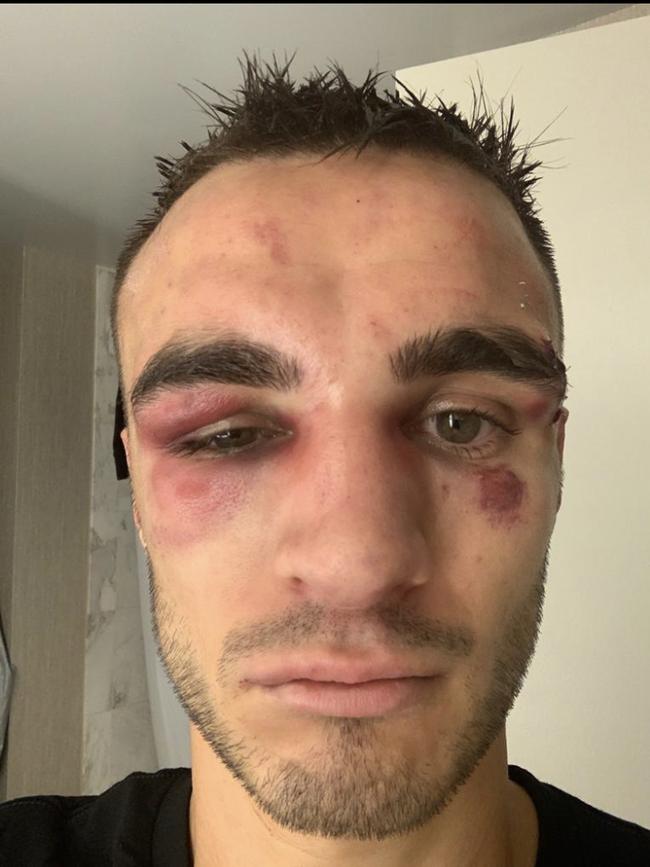 Australian boxer Andrew Maloney after his world title fight.