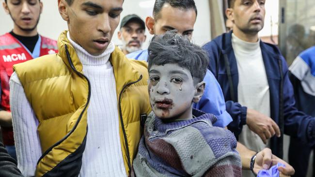 Palestinian boy injured in an Israeli airstrike. Picture: Ahmad Hasaballah