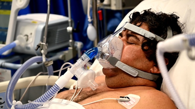 This is what being on ventilated in ICU with Covid-19 looks like