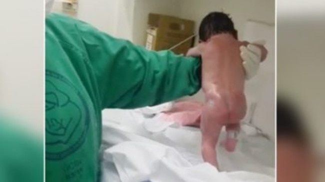 The nurse was left in shock when the baby tried to take a few steps.