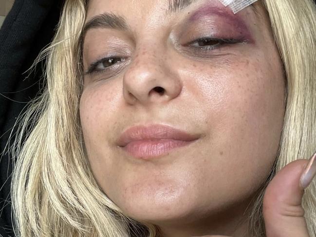 Rexha was seriously injured.