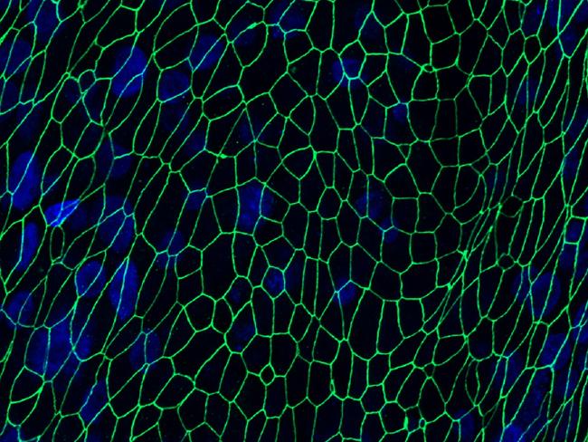 Synthetic lab-grown human airway cells with cell junctions stained green and cell nuclei stained blue. Picture: CSIRO