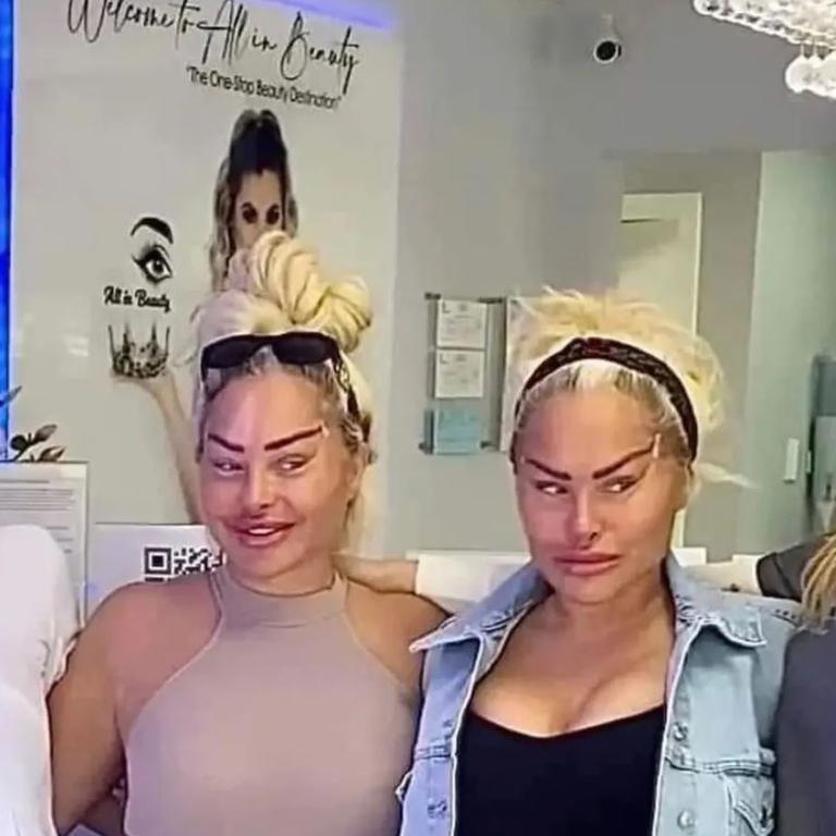 90 Day Fiance stars Darcey and Stacey Silva unrecognisable after facelifts  | NT News