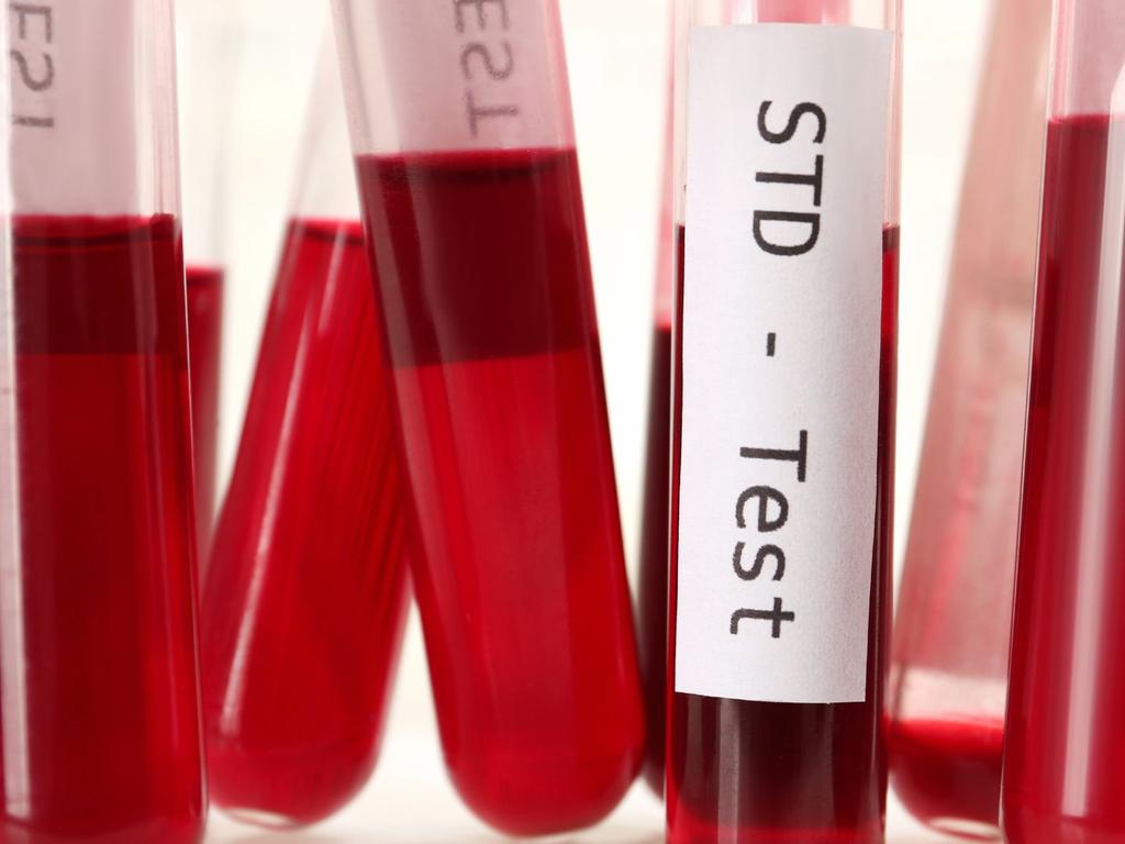 Sexually transmitted infections are rising as people neglect to get tested.