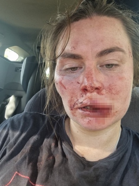 Last year, Sissy Austin was attacked near where Samantha Murphy has gone missing.