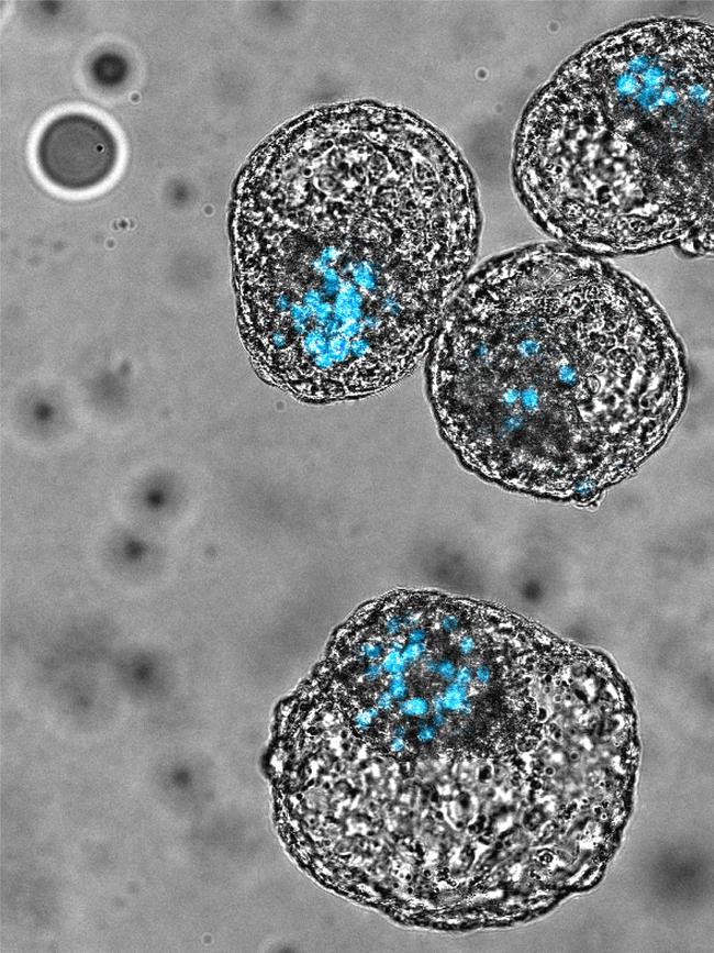 iBlastoids - Models of early human embryos. Supplied Monash University