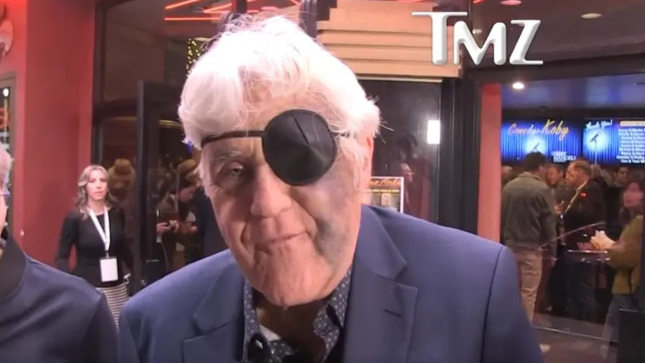 Jay Leno sports an eye patch over a swollen face and bruises following an accident on a hill in LA. Picture: TMZ/BACKGRID