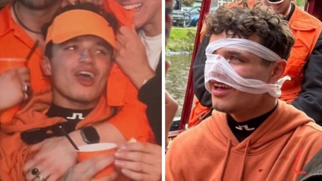 Lando Norris hurt his nose in Amsterdam.