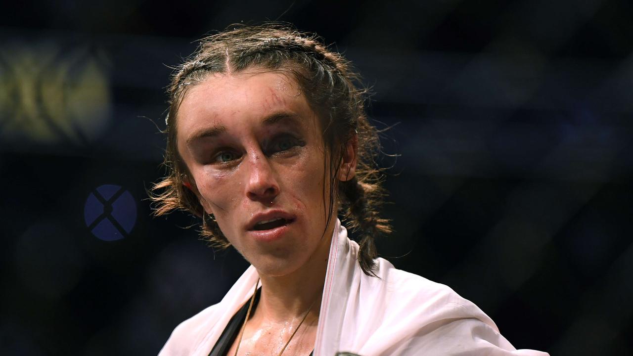 Joanna Jedrzejczyk shows off healing forehead after suffering horror ...