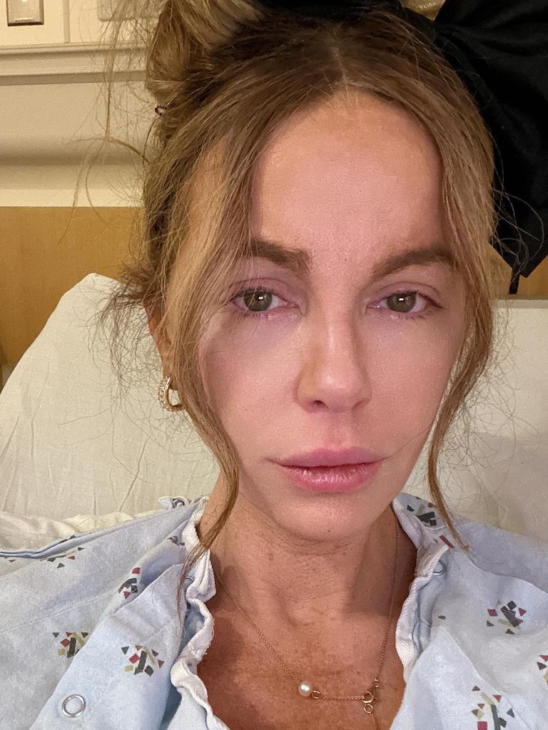 Kate Beckinsale deletes pics from mystery hospital stay | The Advertiser