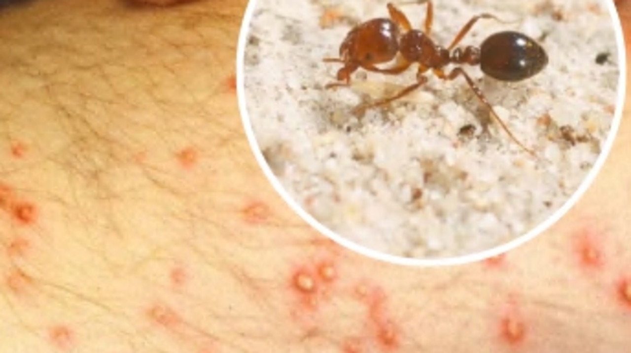 Fire Ants: Qld And NSW Red Fire Ant Infestation, Sniffer Dogs Used To ...