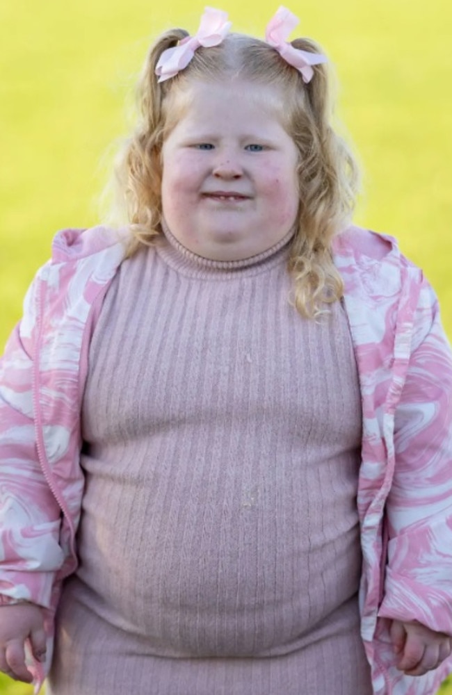 Harlow, five, has Prader-Willi syndrome. Picture: Caters News Agency