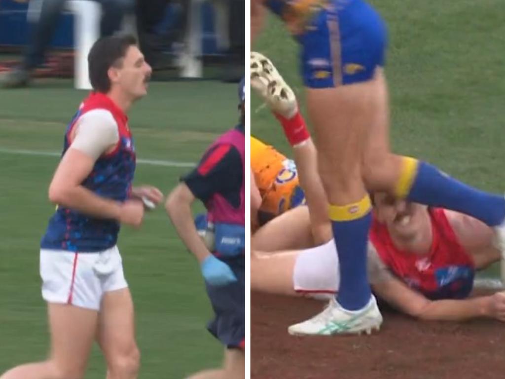 Jake Lever left the field after this nasty collision.