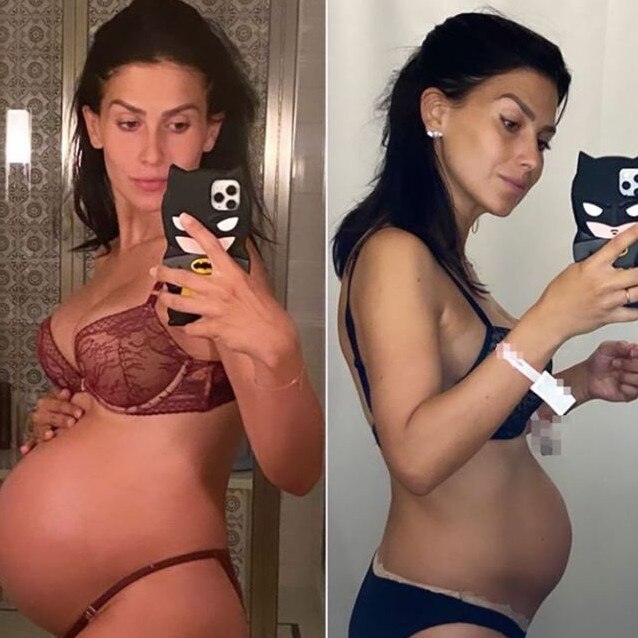 Hilaria Baldwin shares post-baby bod one day after giving birth.