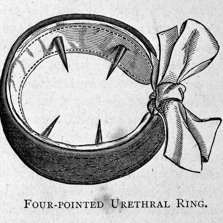 Four-pointed urethral ring for the treatment of masturbation. Picture: CC BY/Wellcome Collection