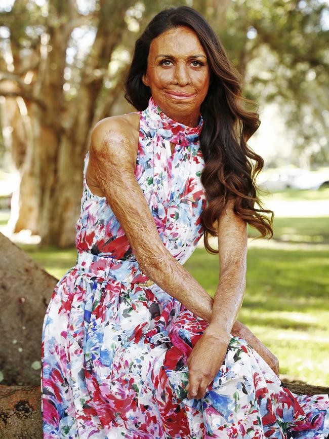 Turia Pitt was severely injured in a grass fire while running an ultra-marathon almost 10 years ago. Picture: Sam Ruttyn