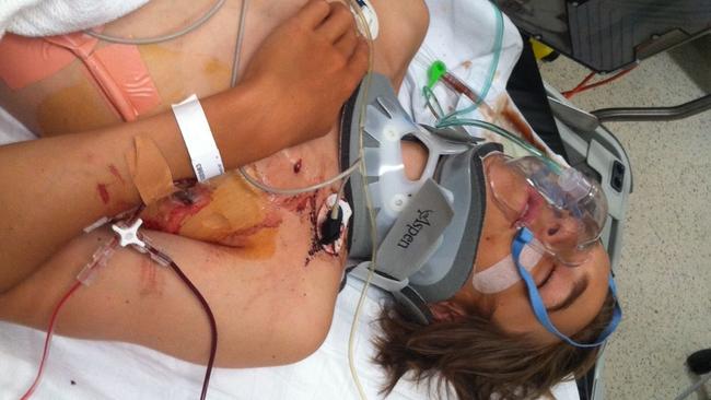 The then 15-year-old suffered serious injuries. Picture: Supplied.