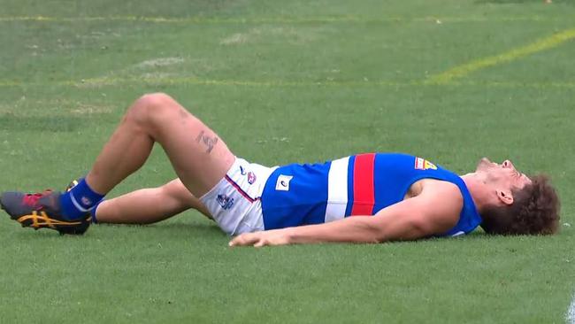 Tom Liberatore grimaces in pain. Picture: Fox Sports