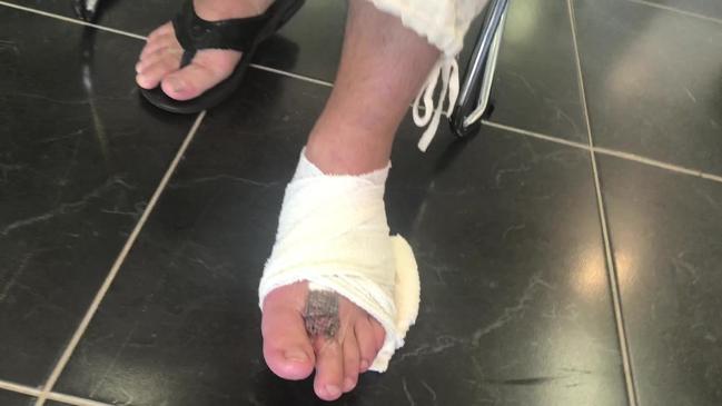 Irish luck runs out after stonefish sting | The Courier Mail