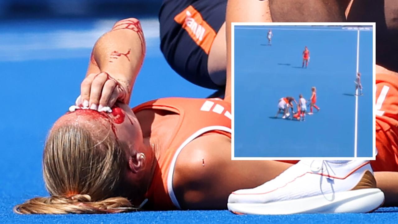 Joosje Burg took it hard in the face. Photo: AFP.