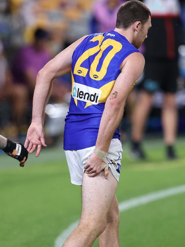 Jeremy McGovern left the ground clutching at his hamstring. Picture: Michael Klein