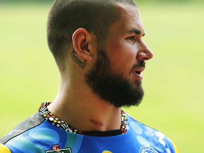 The surgical scar that resulted from treatment for a broken neck is visibly seen on Nathan Peats. Picture: Brett Costello