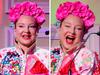 Sia reveals new look after ‘amazing facelift’