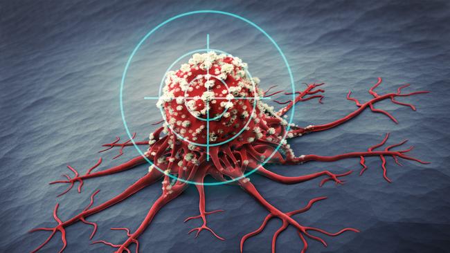 New tech is designed to allow killer cells to target cancers, without causing a great many nasty side effects. Picture: iStock