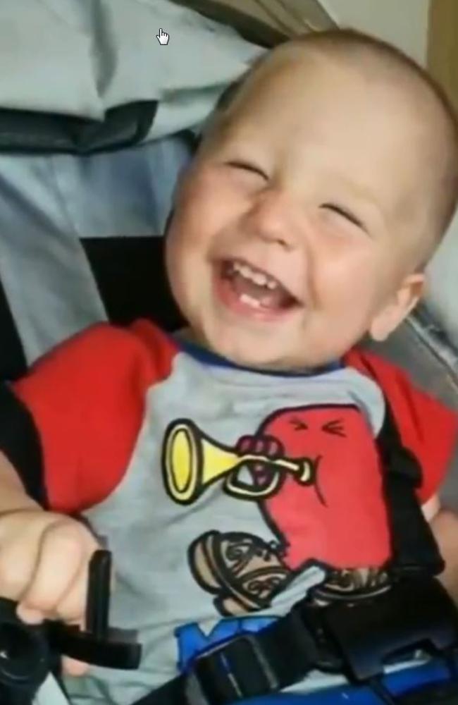 Tiny Tom Higgins is recovering after his ear was surgically reattached. His ear was torn off when he was dragged off his bike by a Great Dane in Newcastle on Tuesday evening. Picture: Channel 10