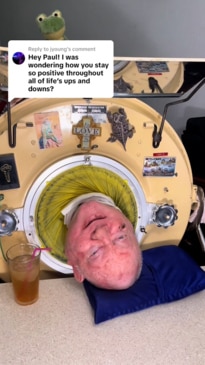 Man who spent 70 years in iron lung has died