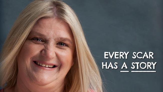 Congenital heart disease survivor Jeanette Manson today.