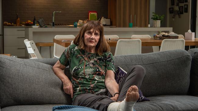 Anne Hunt was recently diagnosed with the flesh eating Buruli Ulcer. Picture: Brad Fleet