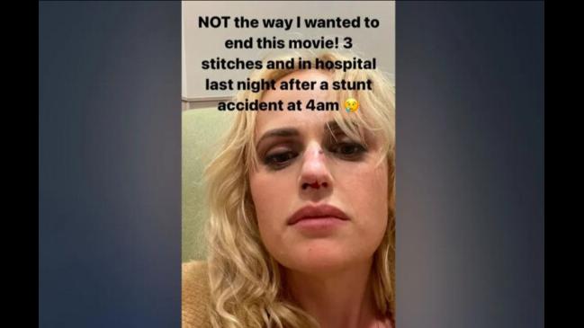 Rebel Wilson Needed Stitches After A “stunt Accident” On The Set Of ...