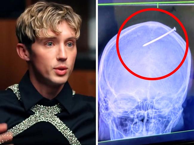 Troye Sivan and his father's horrifying injury. Picture: Channel 10.